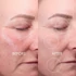 Kép 3/6 - DERMA EXPERT LED LIGHT TREATMENT – Anti-aging LED maszk